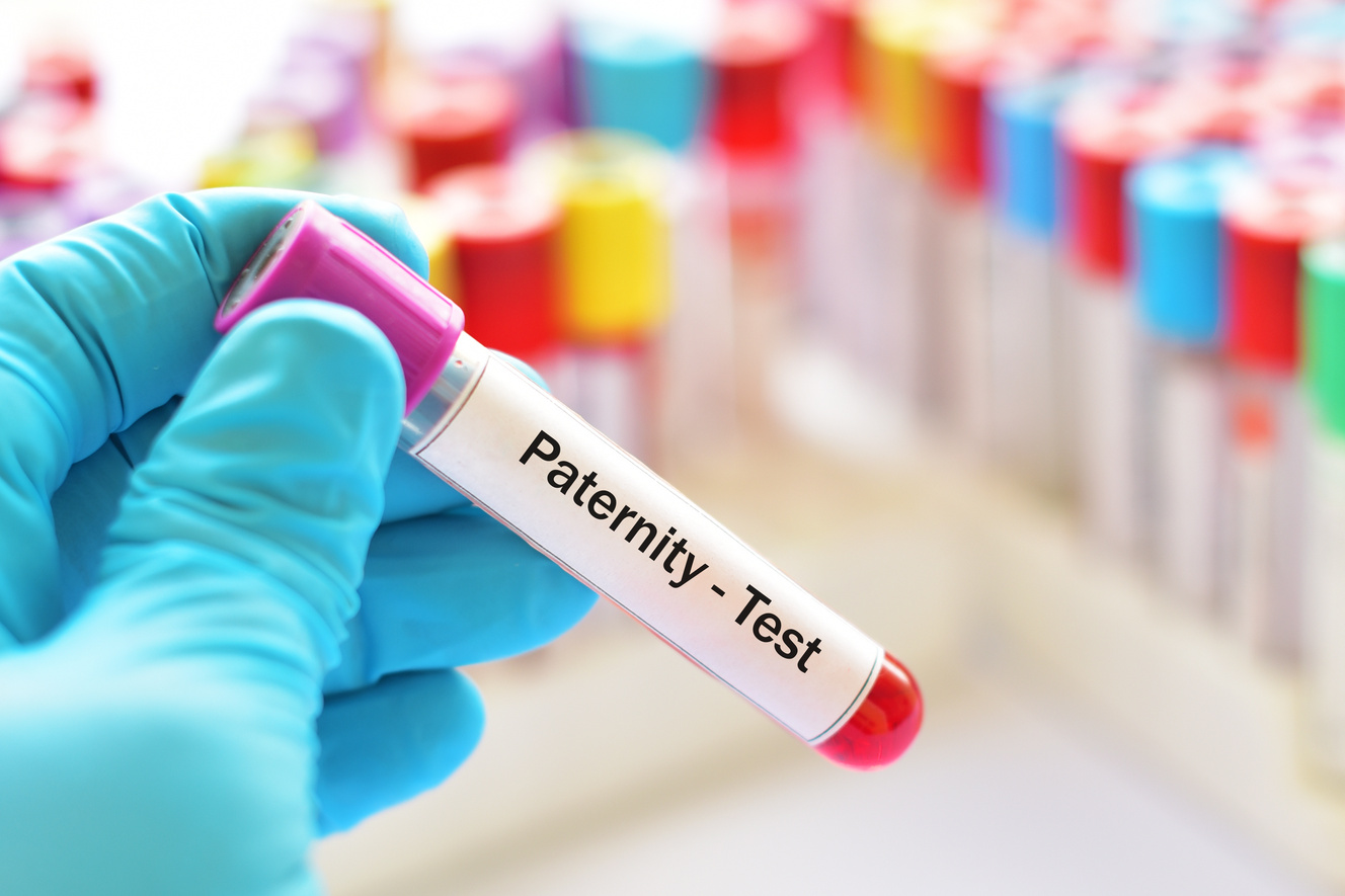 Blood sample for paternity test